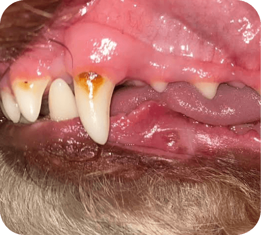 Grade 1 - Mild buildup