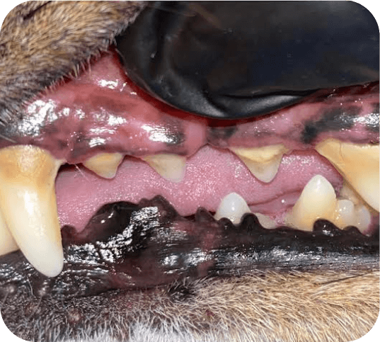Grade 2 - Moderate buildup